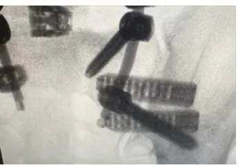 X-ray detail